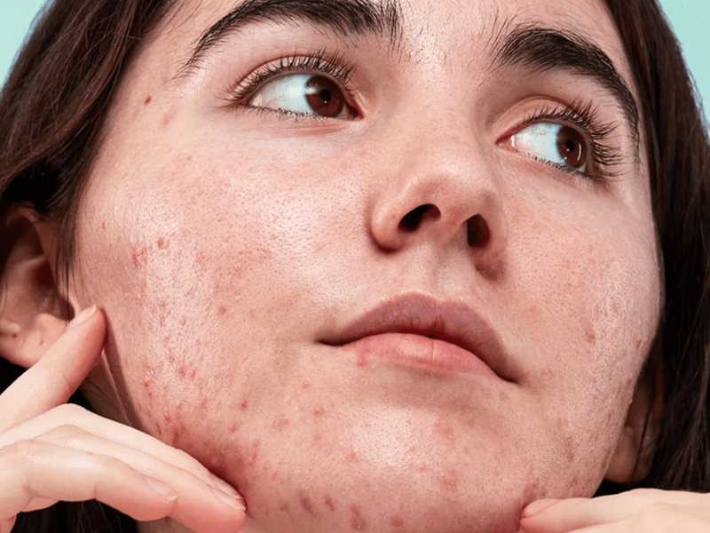 Paid Ads for&nbsp;Skincare